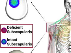 Schaubild eines Schultergelenks